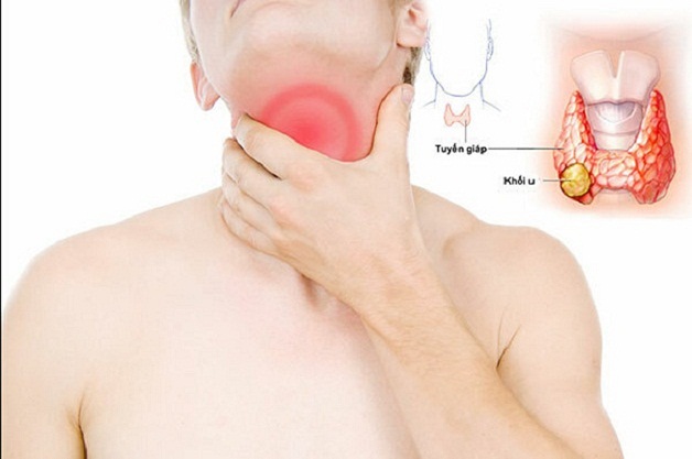 NHÂN TUYẾN GIÁP