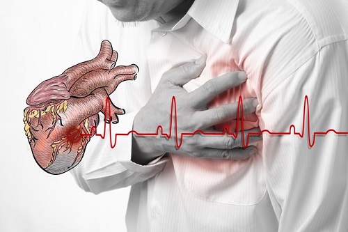 ADDING A SURGERY THERAPY FOR HEART DISEASE