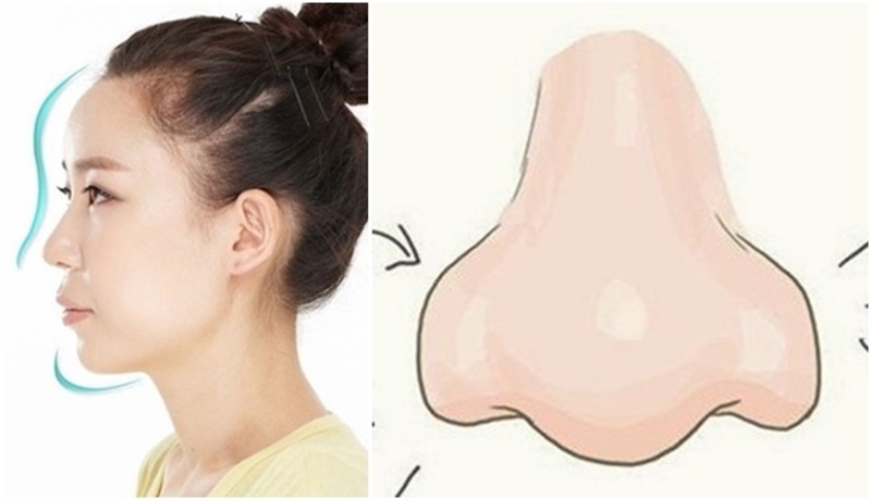 Tổng hợp những dáng mũi không nên sửa
