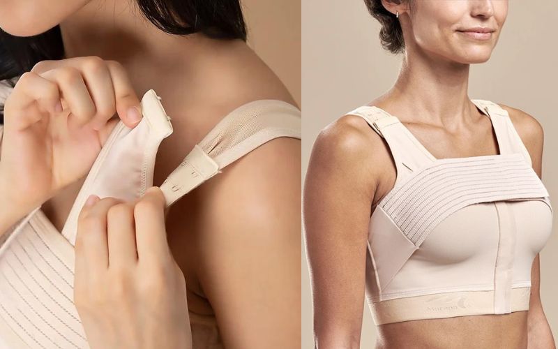 Chăm sóc hồi phục sau khi phẫu thuật nâng ngực