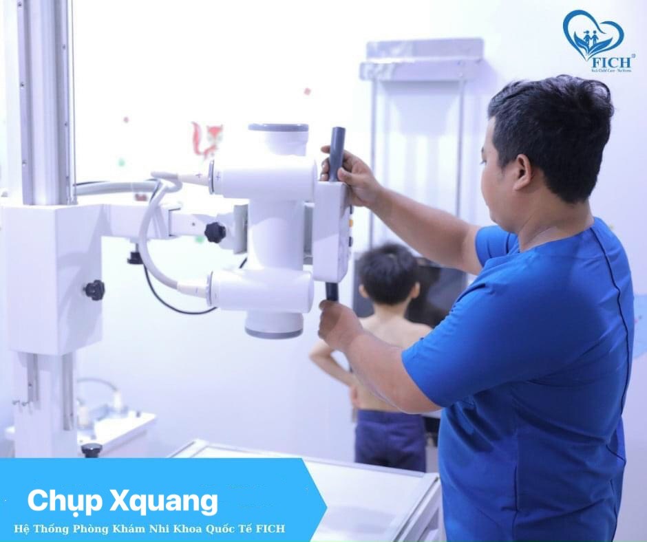 Chụp Xquang tim phổi