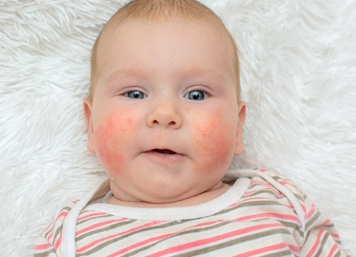 What to do when the baby has an allergy to antibiotics?