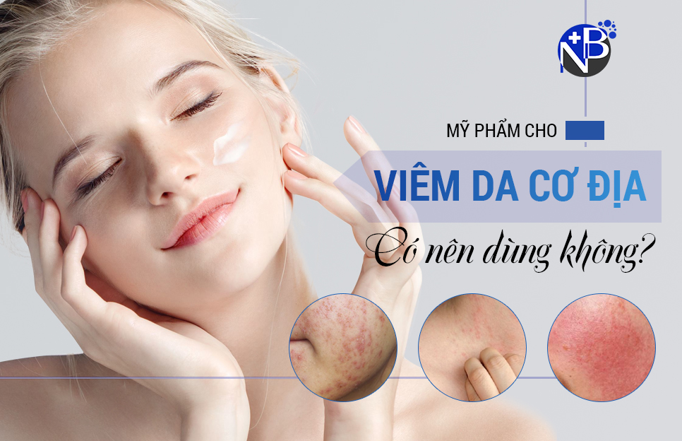 MỸ PHẨM CHO VIÊM DA CƠ ĐỊA – CÓ NÊN DÙNG KHÔNG
