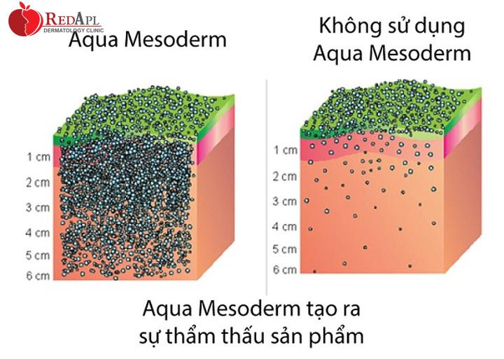 dieu-tri-mun-bang-may-aqua-meso