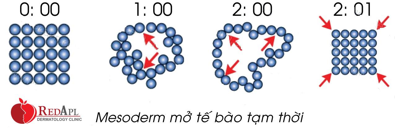 dieu-tri-mun-bang-may-aquameso