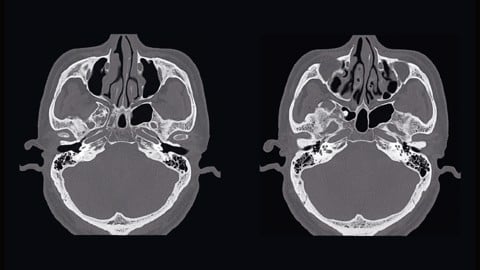 Quy trình chụp CT SOMATOM tại Phòng khám Đa khoa Phương Nam
