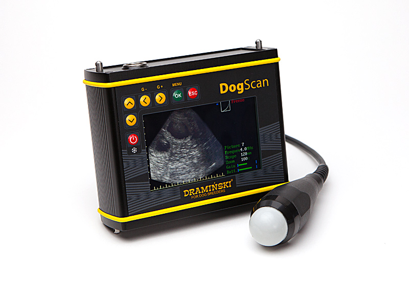 Ultrasound machine